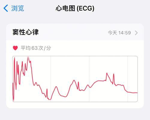 苹果手机心电图查看位置？如何正确使用心电图功能？